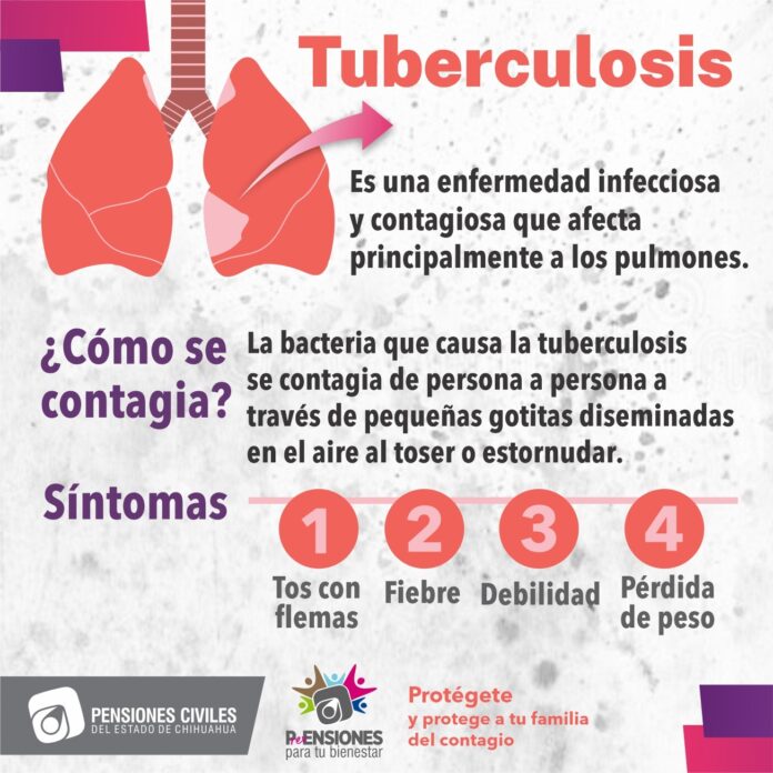 Tuberculosis