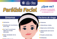 Invitan a reconocer señales para diagnóstico oportuno y tratamiento de la parálisis facial